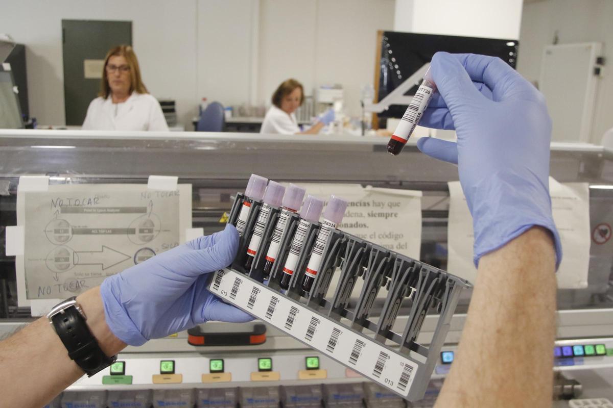 Laboratorios del hospital Reina Sofía donde se analizan muestras.