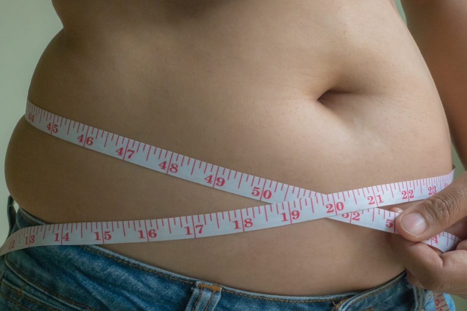 Excess kilos go unnoticed in the medical history of 40% of people with obesity