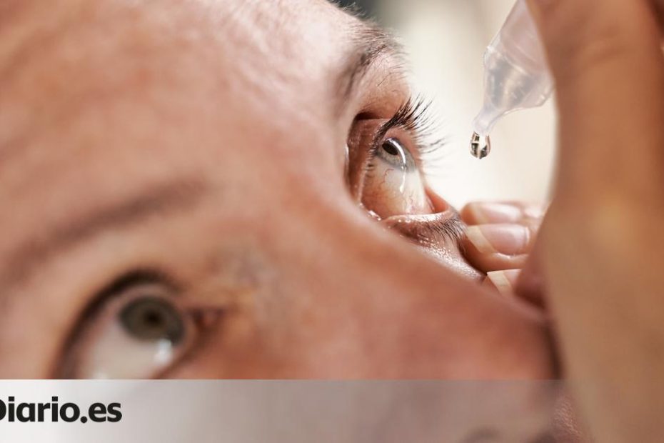 Home remedies to cure styes, inflammation and eye infections: what ophthalmologists say